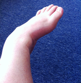 My usless left foot